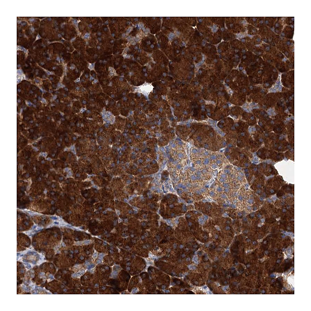 Atlas Antibodies Anti-ALKBH7 Antibody