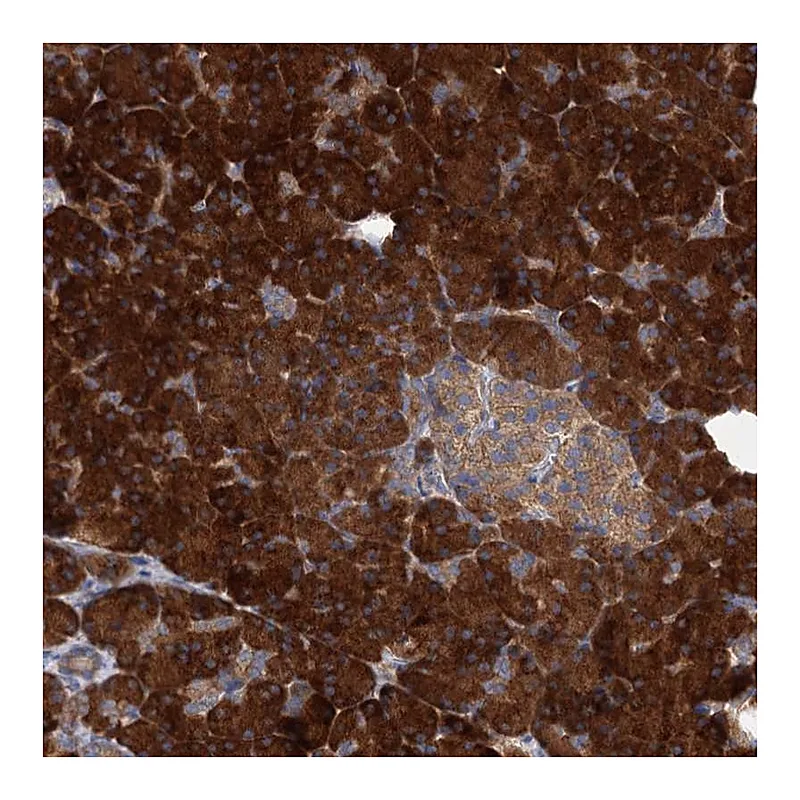 Atlas Antibodies Anti-ALKBH7 Antibody
