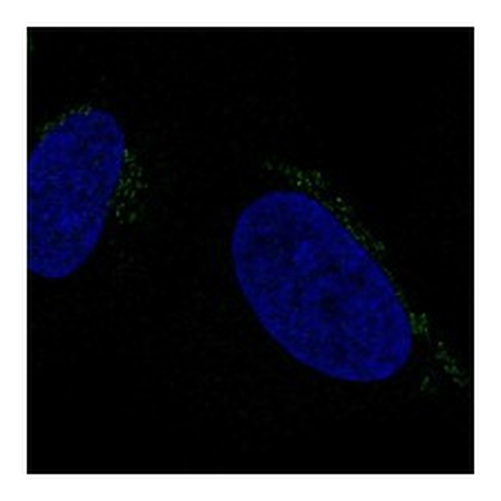 Atlas Antibodies Anti-ALKBH7 Antibody