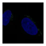 Atlas Antibodies Anti-ALKBH7 Antibody