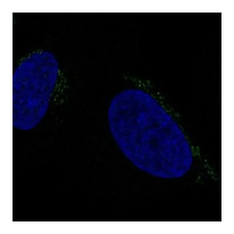 Atlas Antibodies Anti-ALKBH7 Antibody
