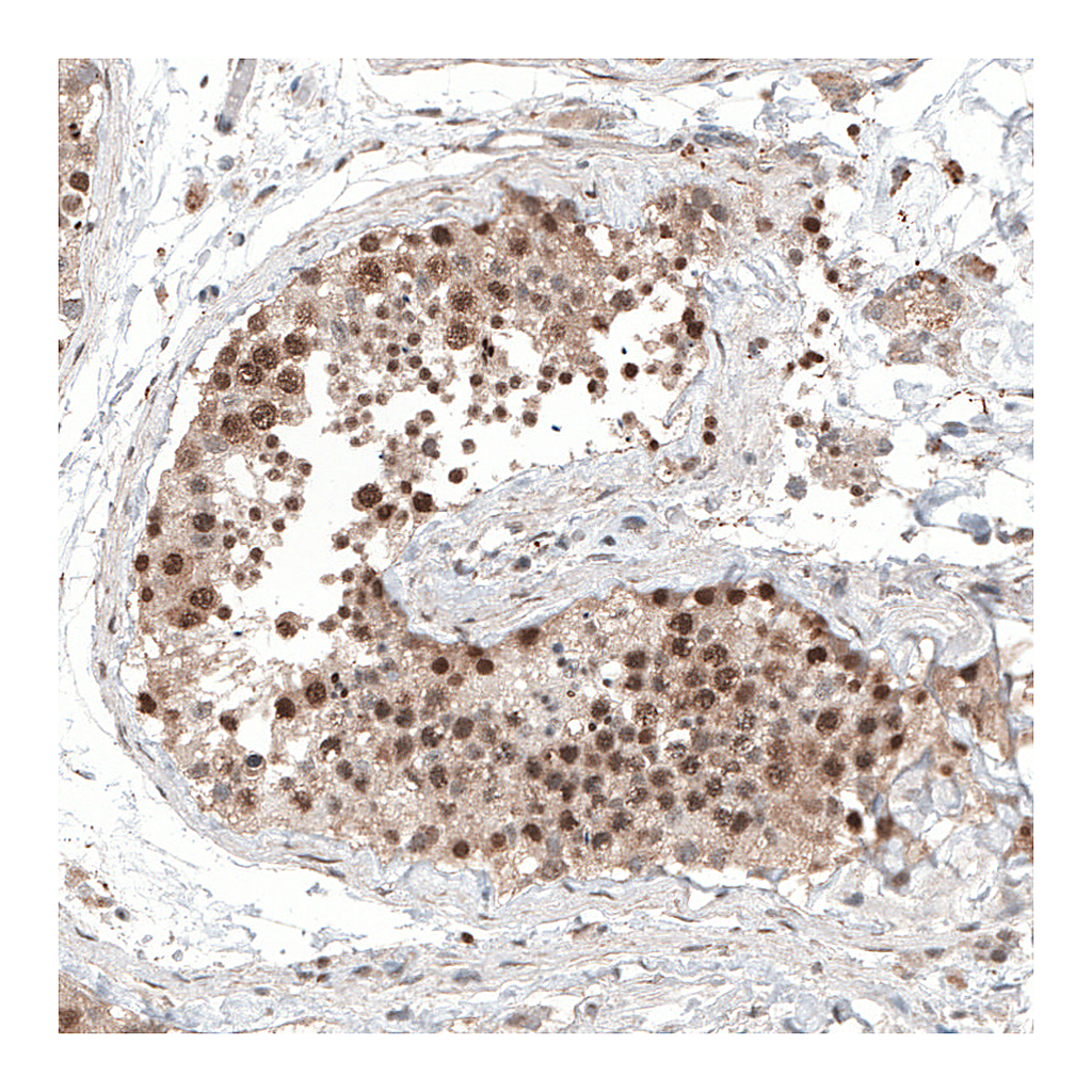 Atlas Antibodies Anti-ALKBH5 Antibody