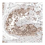 Atlas Antibodies Anti-ALKBH5 Antibody