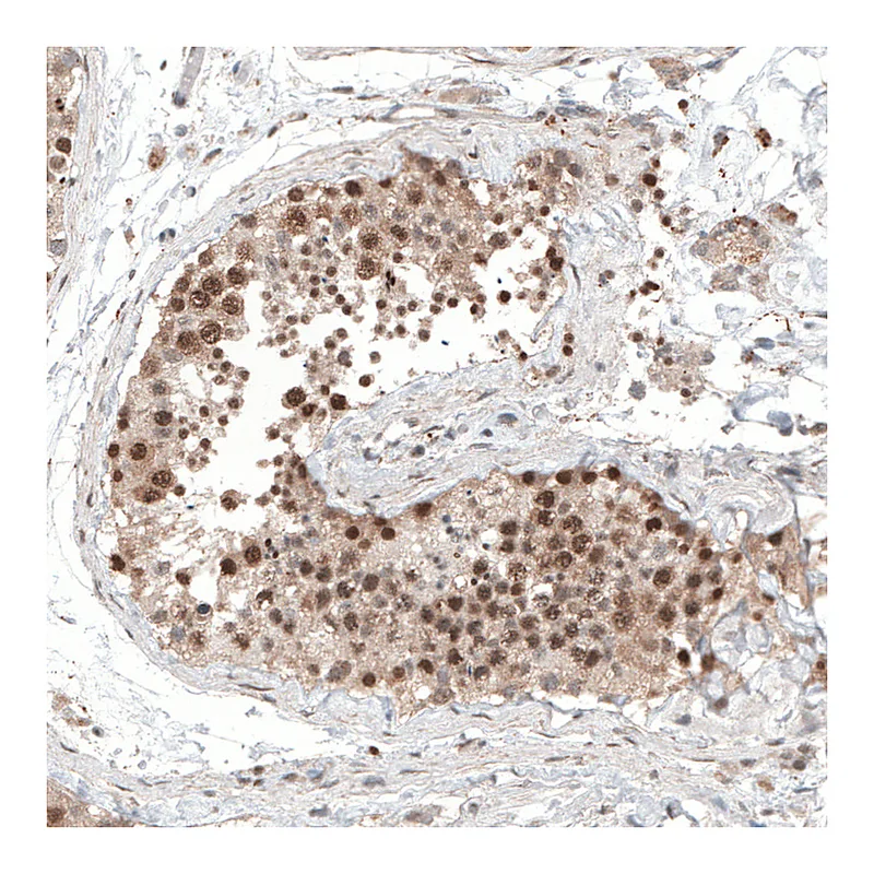 Atlas Antibodies Anti-ALKBH5 Antibody