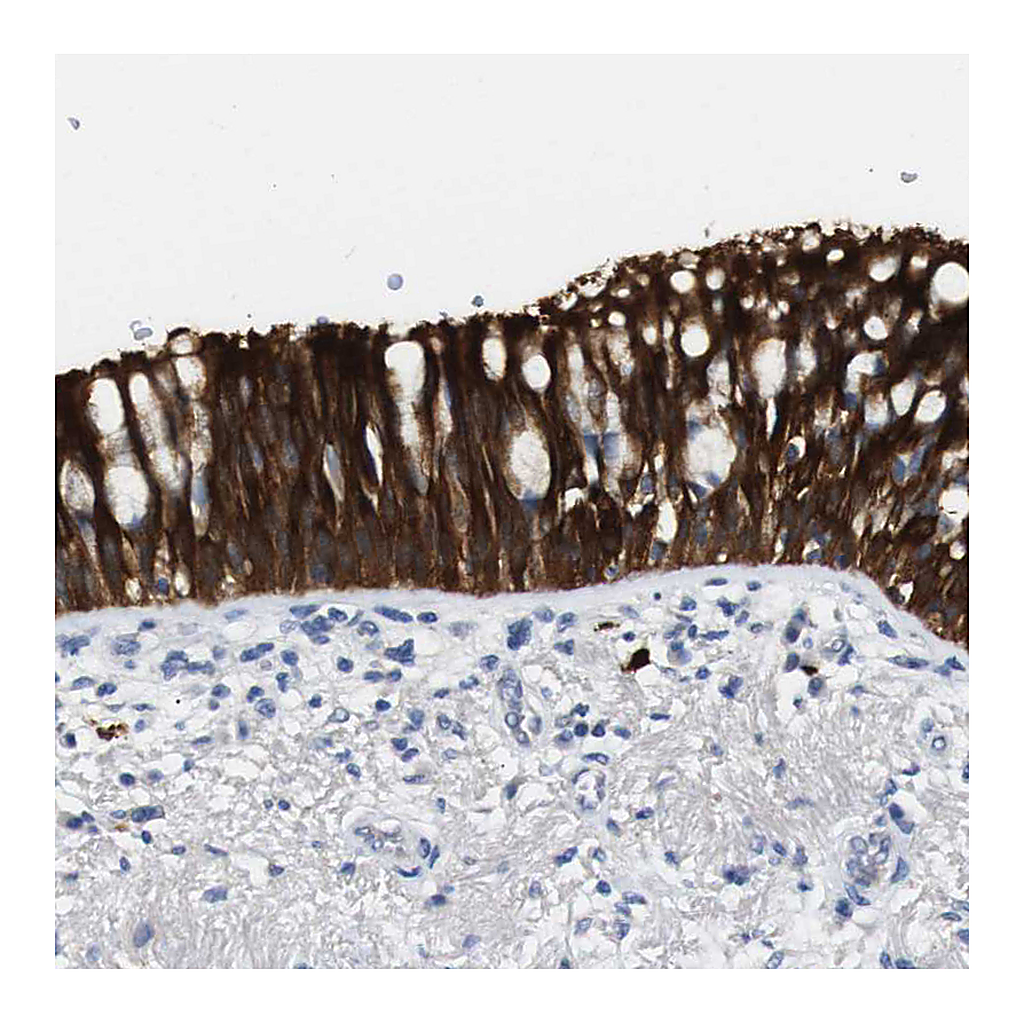 Atlas Antibodies Anti-ALOX15 Antibody
