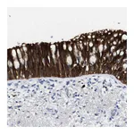 Atlas Antibodies Anti-ALOX15 Antibody