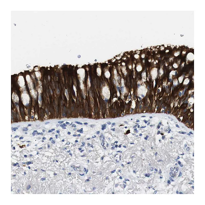 Atlas Antibodies Anti-ALOX15 Antibody