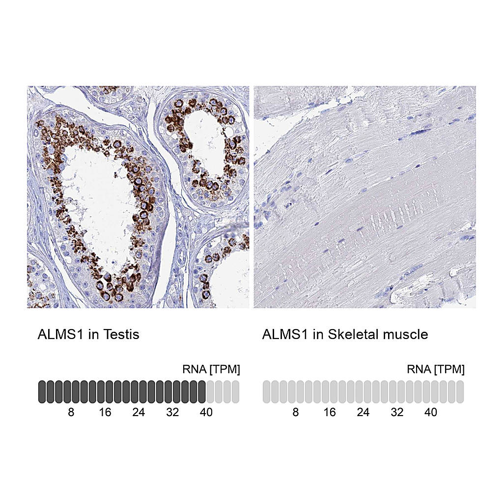 Atlas Antibodies Anti-ALMS1 Antibody