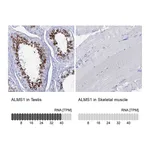 Atlas Antibodies Anti-ALMS1 Antibody