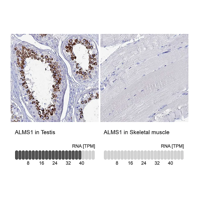 Atlas Antibodies Anti-ALMS1 Antibody