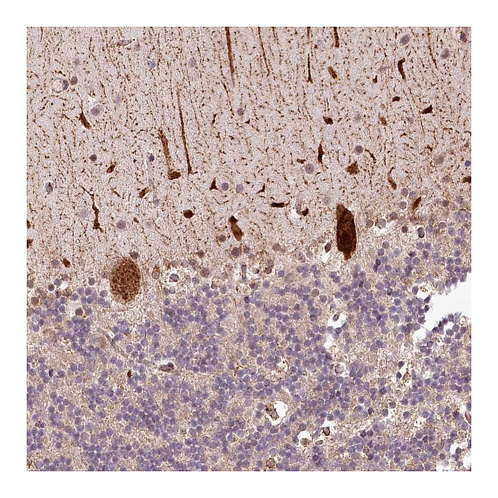 Atlas Antibodies Anti-ALKBH8 Antibody
