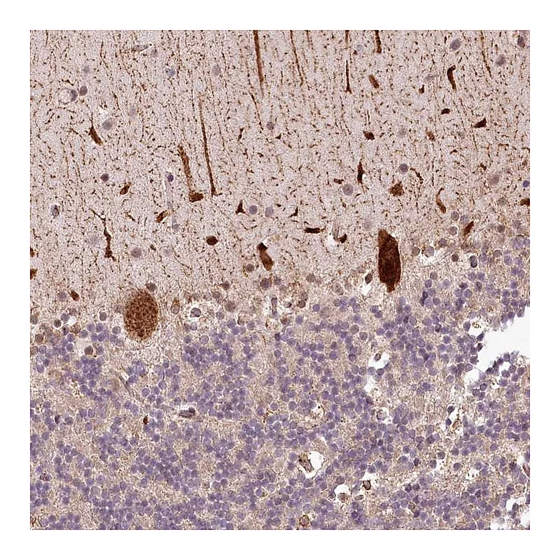 Atlas Antibodies Anti-ALKBH8 Antibody