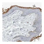 Atlas Antibodies Anti-ALOX12B Antibody