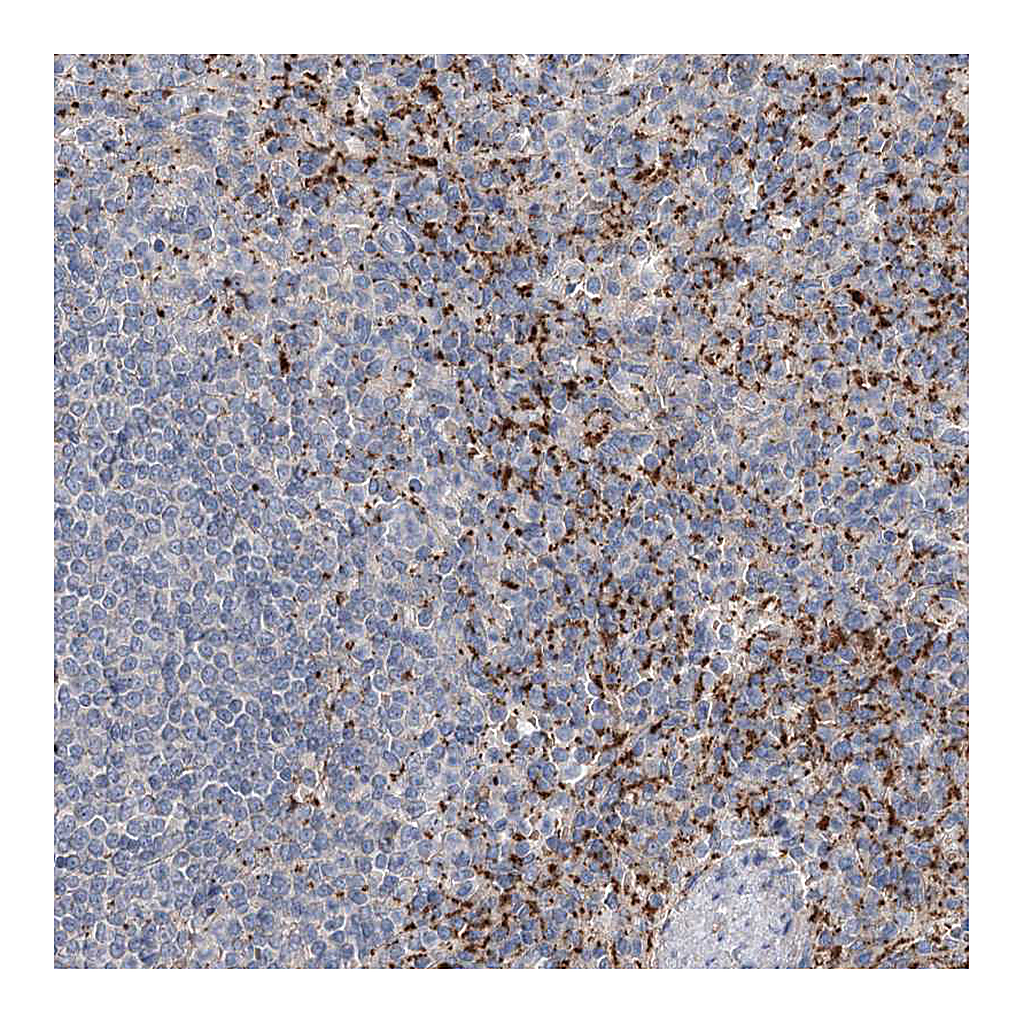 Atlas Antibodies Anti-ALKBH8 Antibody
