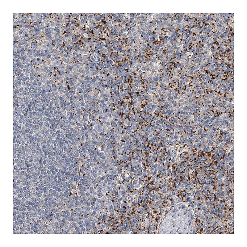 Atlas Antibodies Anti-ALKBH8 Antibody