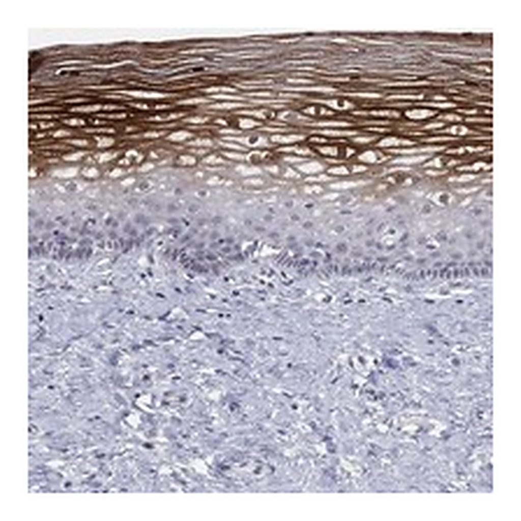 Atlas Antibodies Anti-ALOX12 Antibody