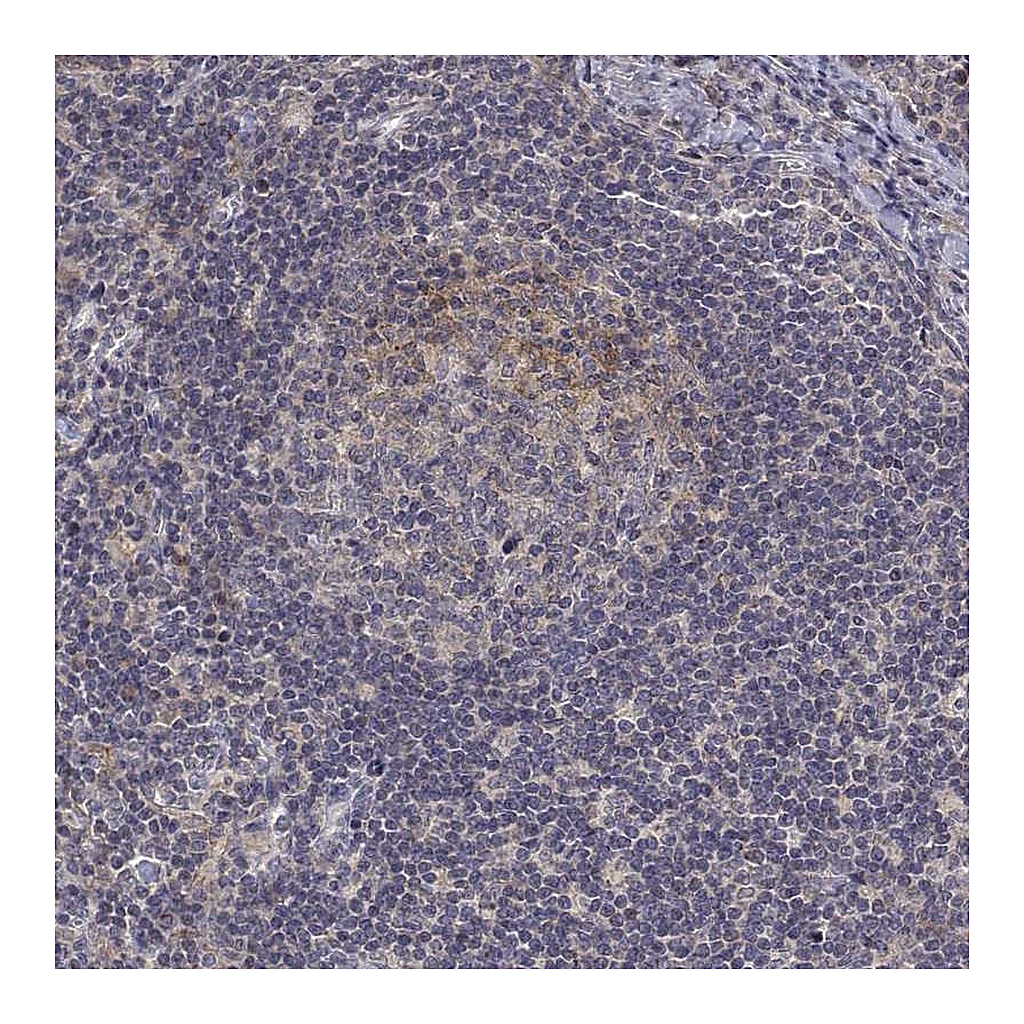 Atlas Antibodies Anti-ALKBH8 Antibody