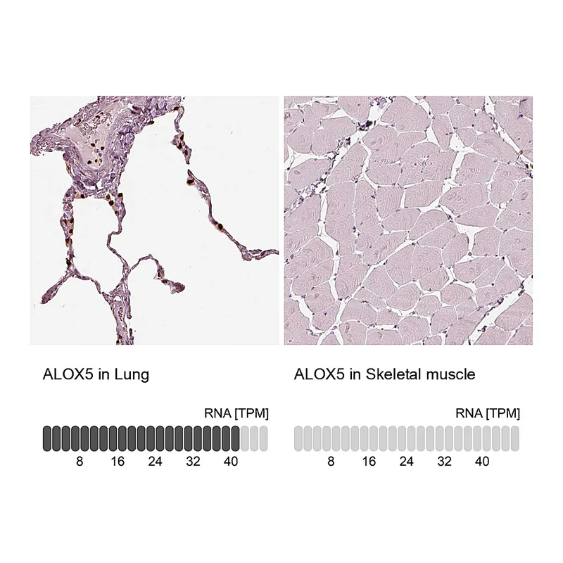 Atlas Antibodies Anti-ALOX5 Antibody