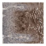 Atlas Antibodies Anti-ALOX12 Antibody