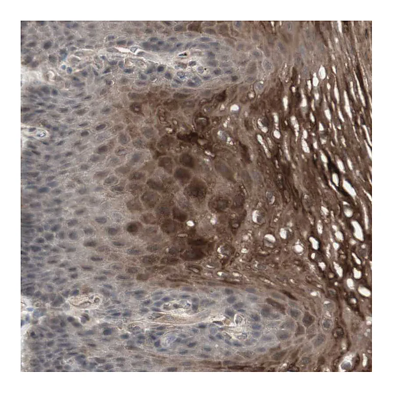 Atlas Antibodies Anti-ALOX12 Antibody