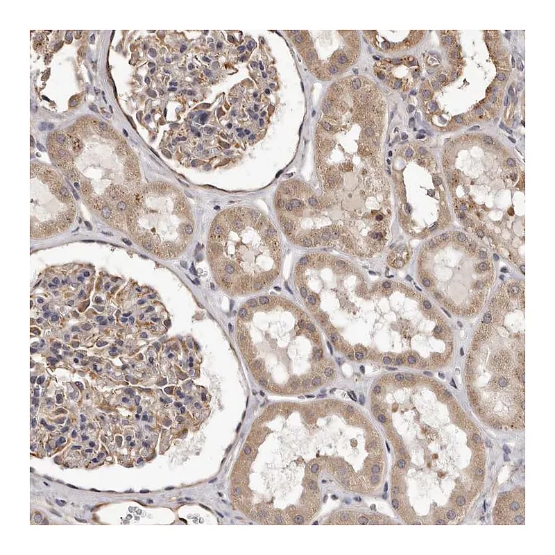 Atlas Antibodies Anti-ALPK1 Antibody