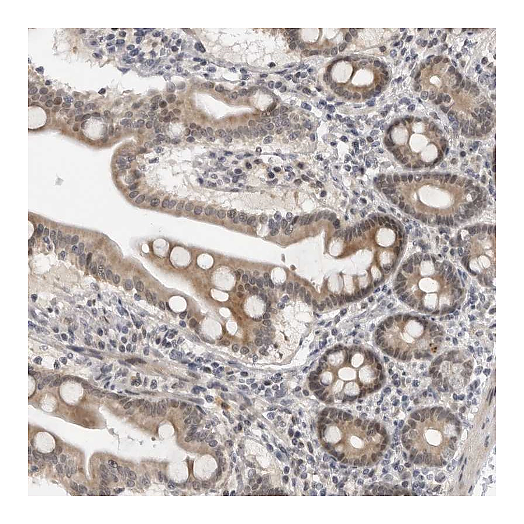 Atlas Antibodies Anti-ALPK2 Antibody