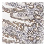 Atlas Antibodies Anti-ALPK2 Antibody