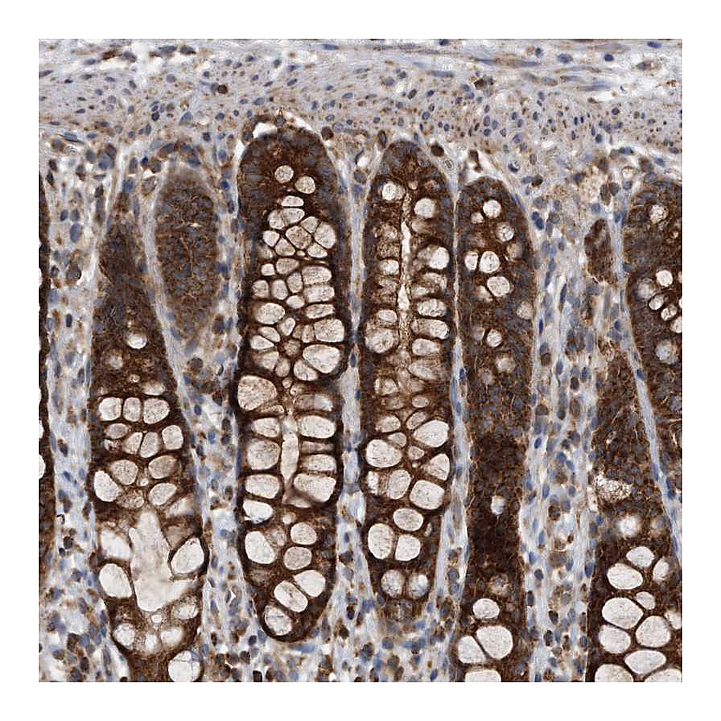 Atlas Antibodies Anti-ALPK2 Antibody
