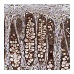 Atlas Antibodies Anti-ALPK2 Antibody