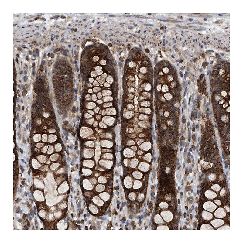Atlas Antibodies Anti-ALPK2 Antibody