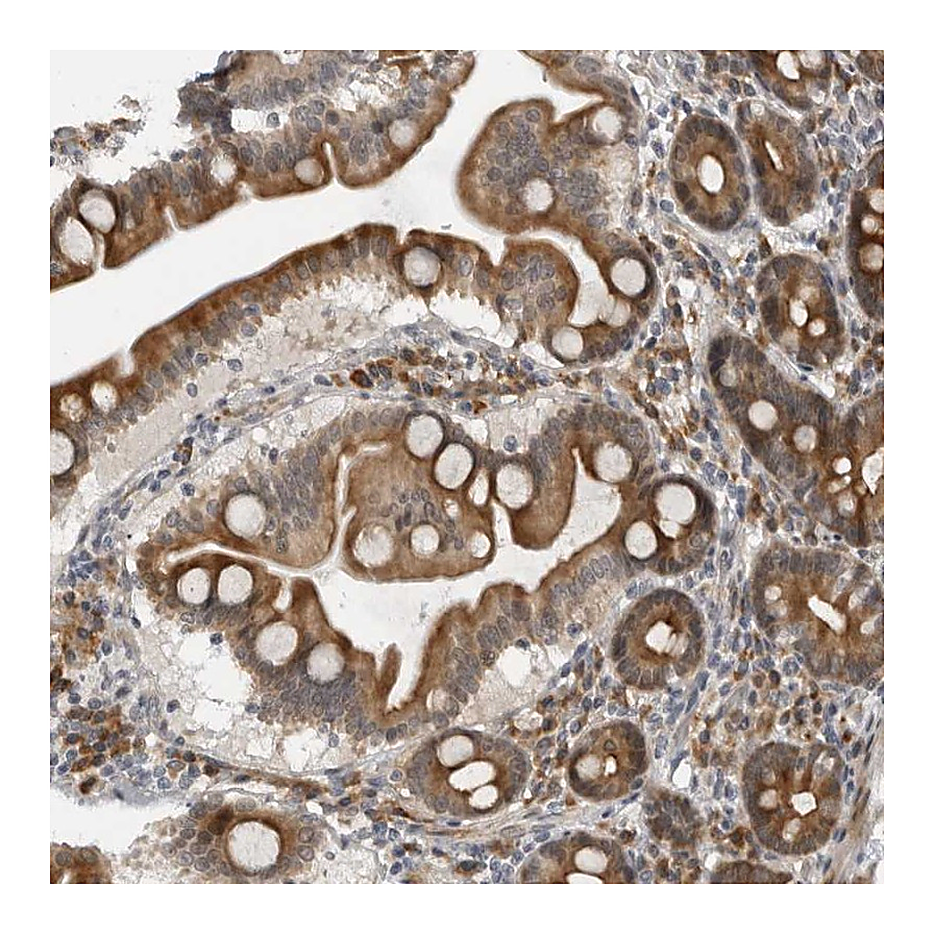 Atlas Antibodies Anti-ALPK2 Antibody