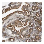 Atlas Antibodies Anti-ALPK2 Antibody