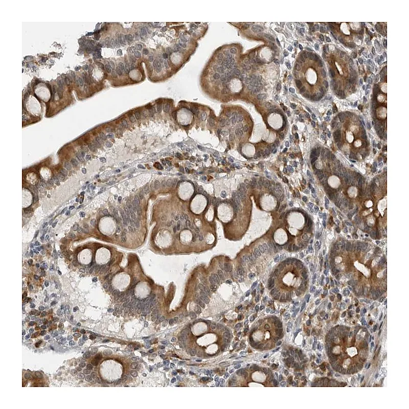 Atlas Antibodies Anti-ALPK2 Antibody
