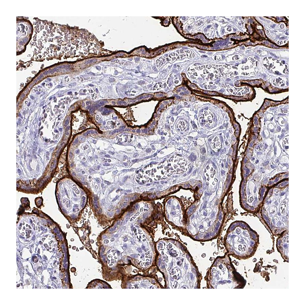 Atlas Antibodies Anti-ALPI Antibody