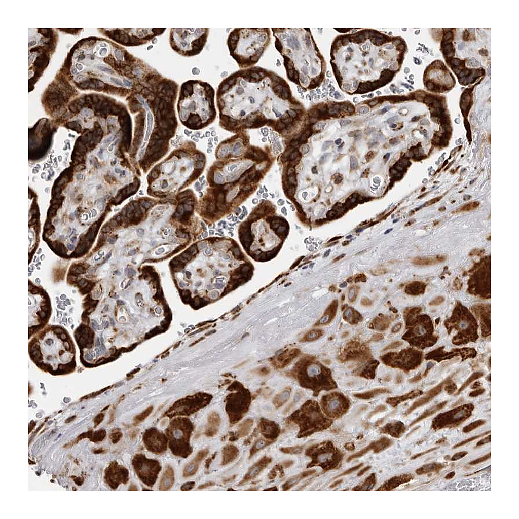 Atlas Antibodies Anti-ALPK2 Antibody