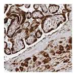 Atlas Antibodies Anti-ALPK2 Antibody