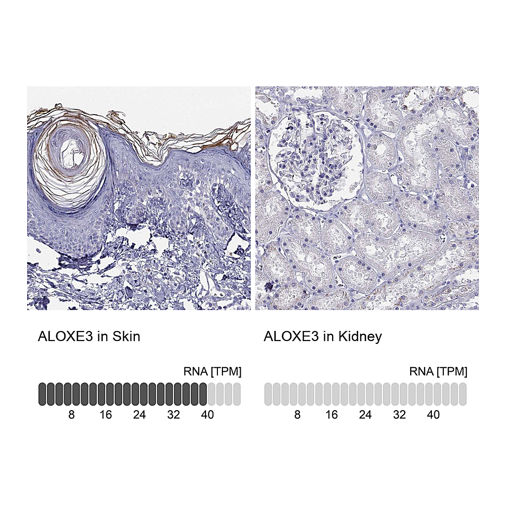 Atlas Antibodies Anti-ALOXE3 Antibody