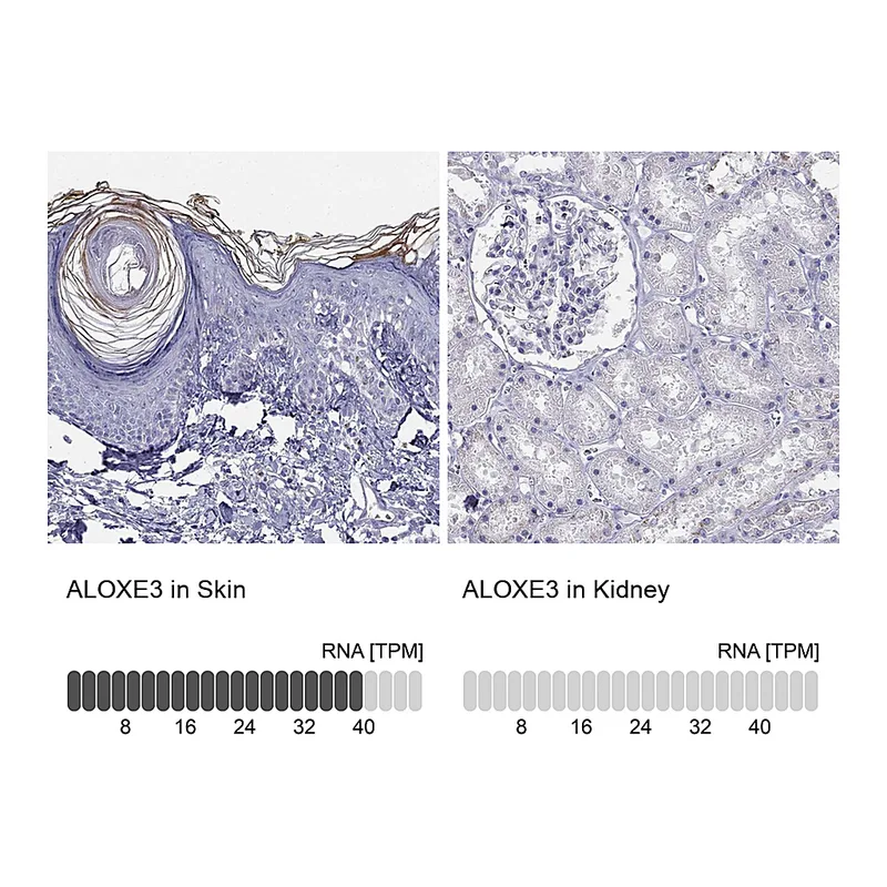 Atlas Antibodies Anti-ALOXE3 Antibody