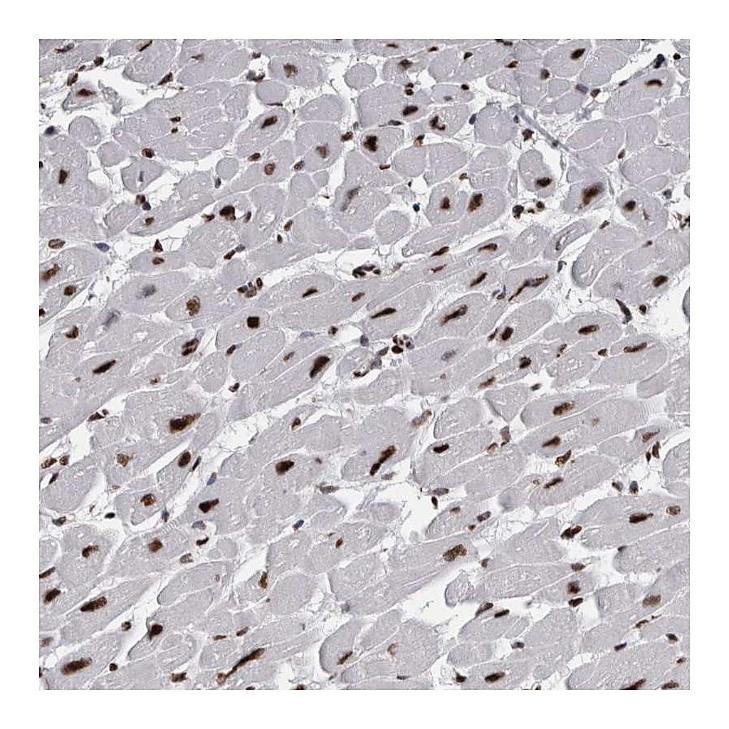 Atlas Antibodies Anti-ALPK3 Antibody