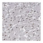 Atlas Antibodies Anti-ALPK3 Antibody
