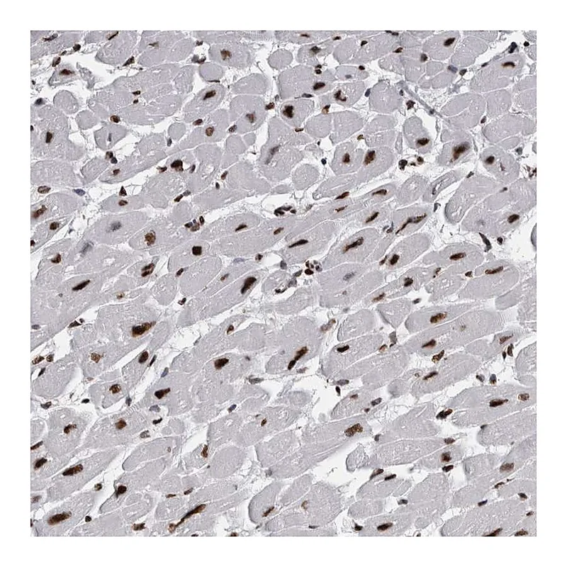 Atlas Antibodies Anti-ALPK3 Antibody