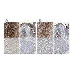 Atlas Antibodies Anti-ALPL Antibody