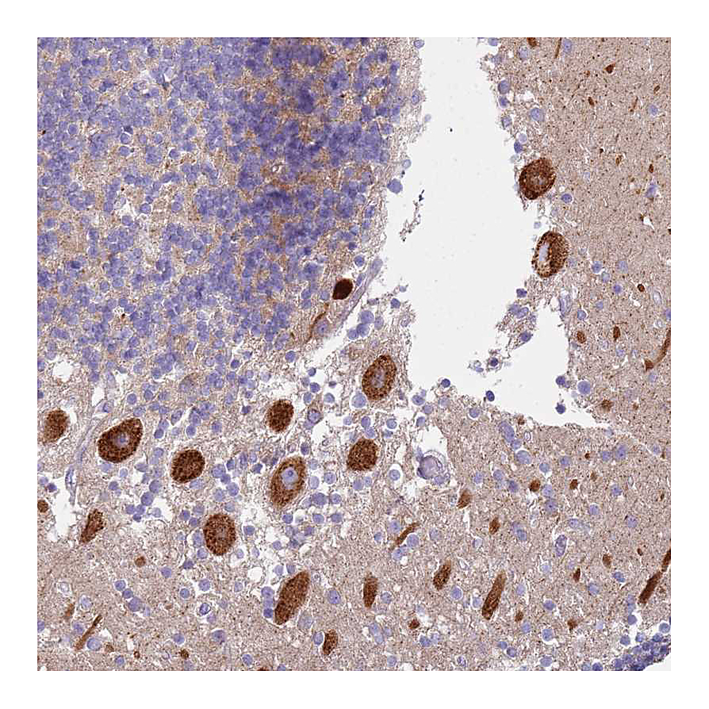 Atlas Antibodies Anti-ALS2 Antibody