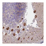 Atlas Antibodies Anti-ALS2 Antibody