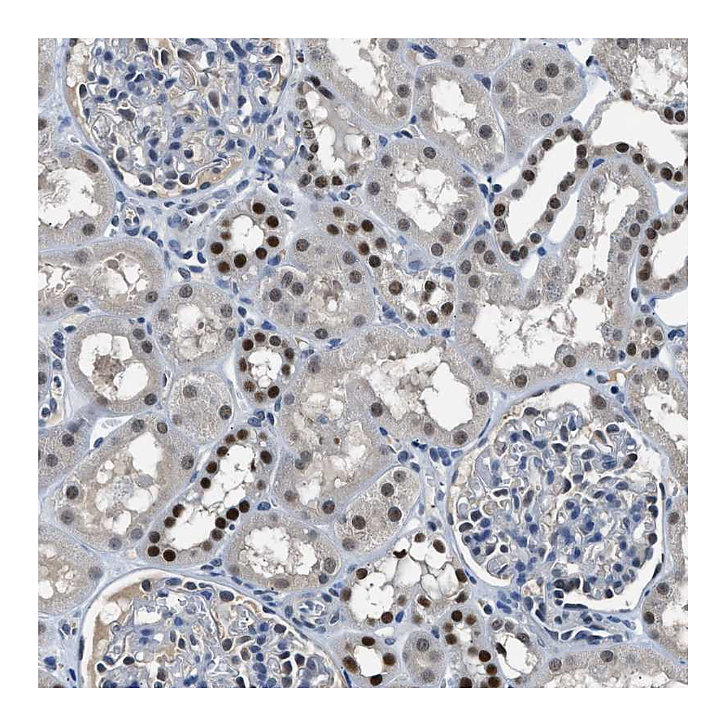 Atlas Antibodies Anti-ALX1 Antibody