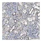 Atlas Antibodies Anti-ALX1 Antibody