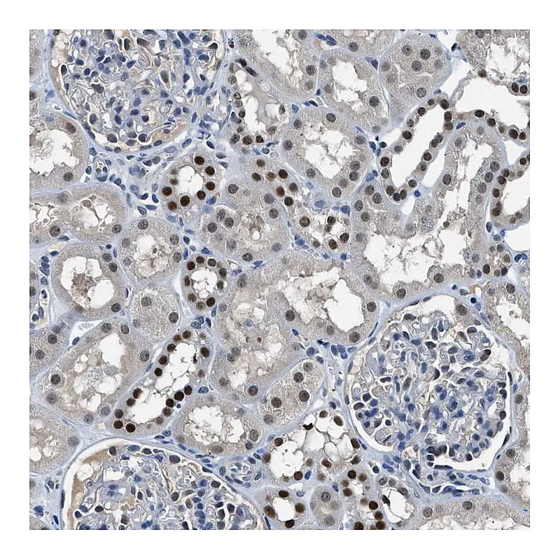 Atlas Antibodies Anti-ALX1 Antibody