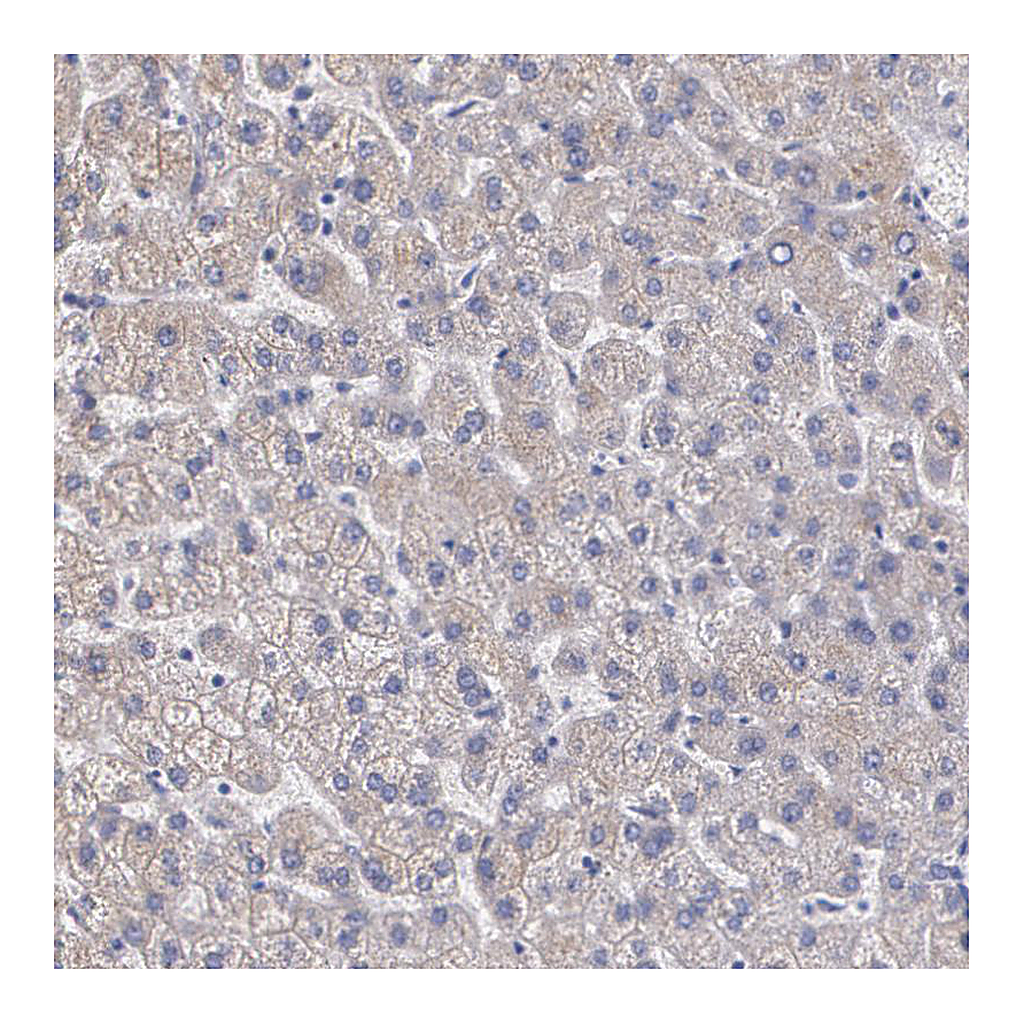 Atlas Antibodies Anti-AMBP Antibody