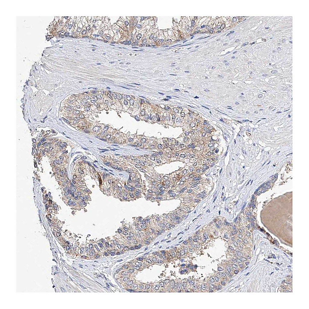 Atlas Antibodies Anti-AMD1 Antibody