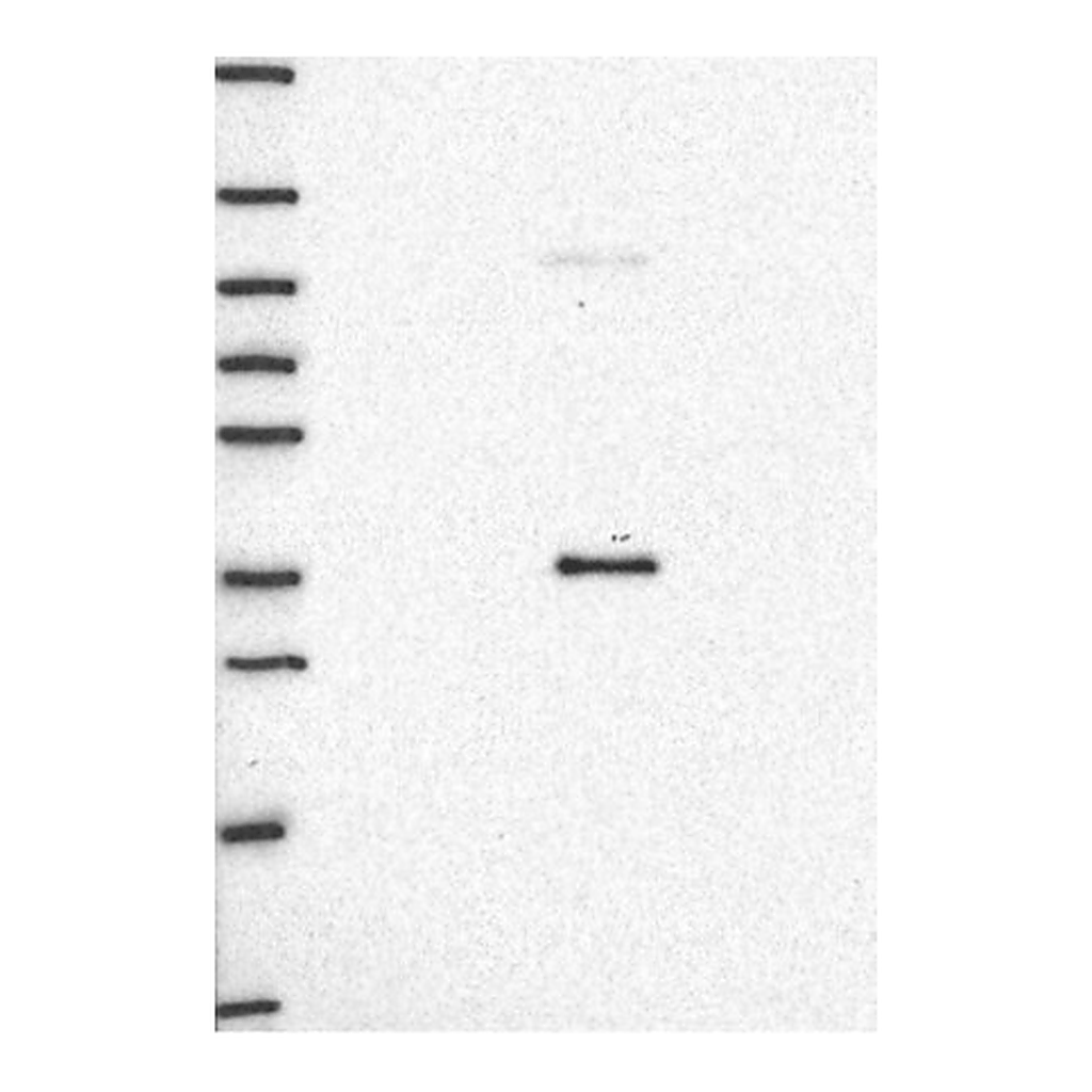Atlas Antibodies Anti-AMBP Antibody